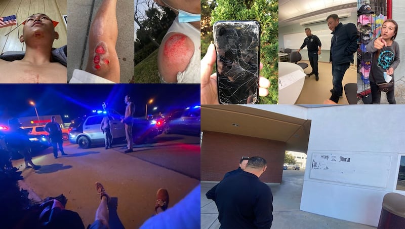 左图:在美的中国异议人士界立建指控,去年一月骑自行车在自家附近遭车辆袭击和副驾驶挥刀刺伤。(界立建提供); 右图:在美的中国异议人士界立建指控,2022年10月声援彭立发,在加利福尼亚核桃市一所学校贴海报遭遇死亡威胁。(界立建提供)